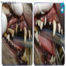 El antes y el despues de la limpieza dental